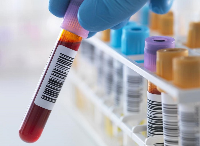 This simple blood test can predict cancer years before symptoms appear